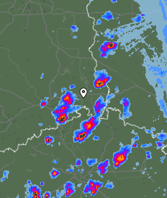 Radar