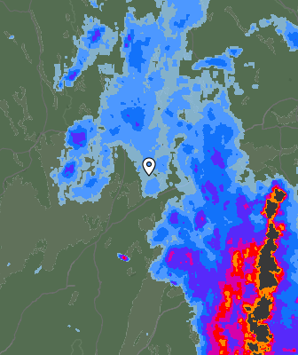 Radar
