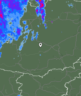 Radar