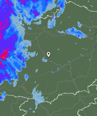 Radar