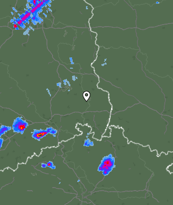 Radar