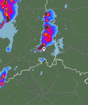 Radar