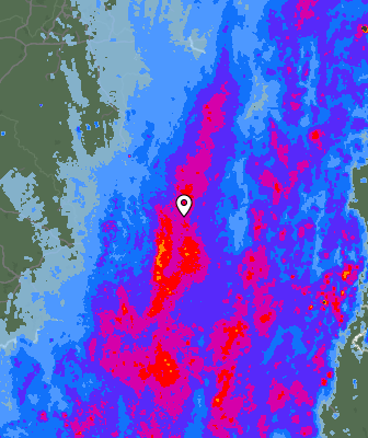 Radar