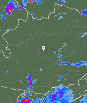 Radar