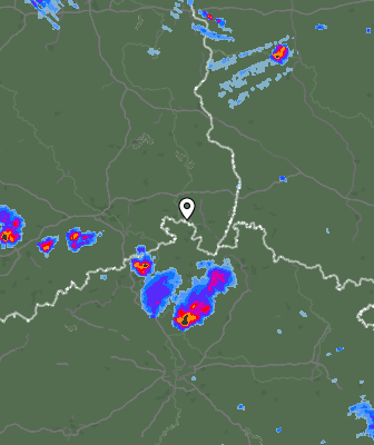 Radar