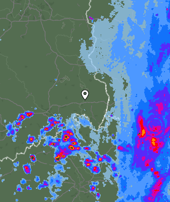 Radar