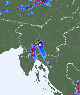 Radar