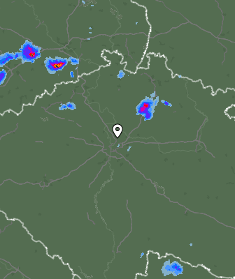 Radar