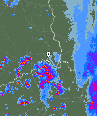 Radar