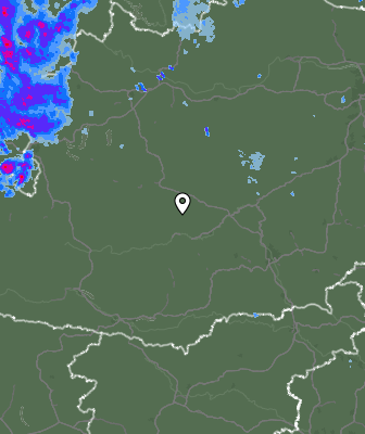 Radar