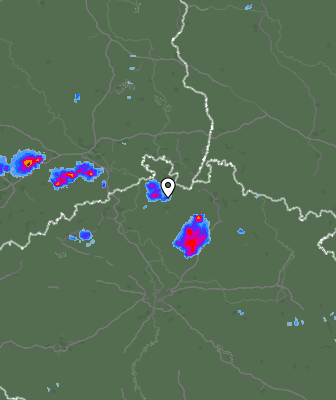 Radar