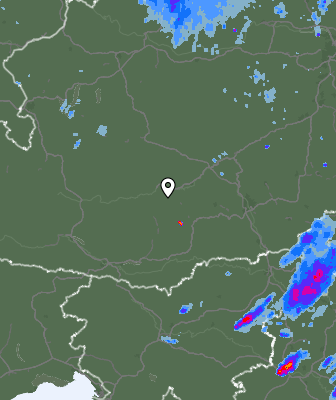 Radar