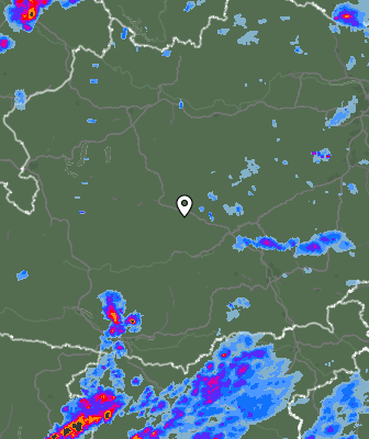 Radar