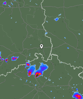 Radar