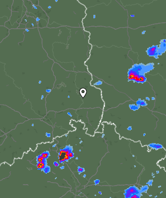 Radar