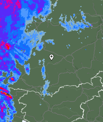 Radar