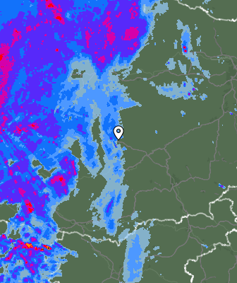 Radar