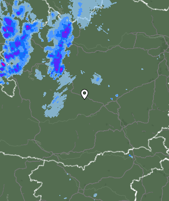 Radar