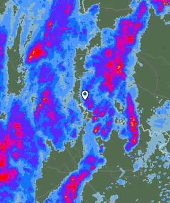 Radar