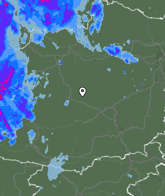 Radar