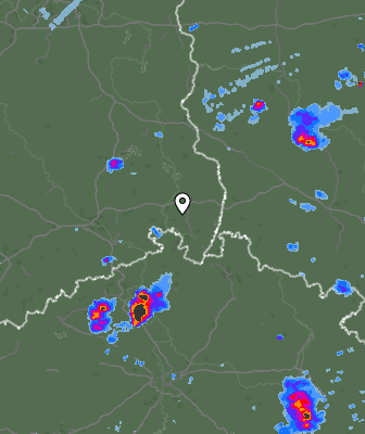 Radar