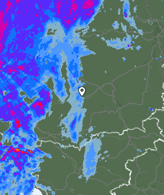 Radar
