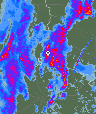 Radar