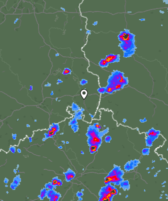 Radar