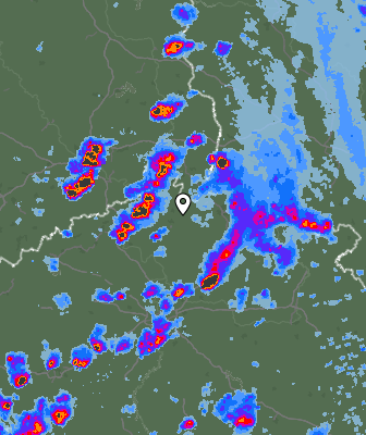 Radar