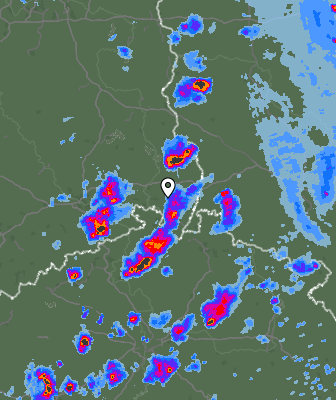 Radar
