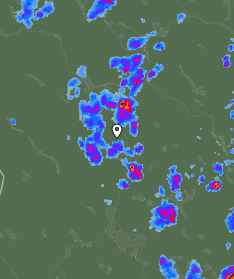 Radar
