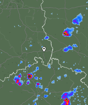 Radar