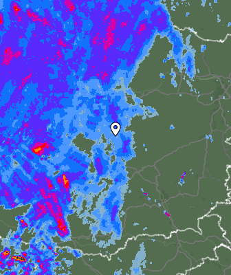 Radar