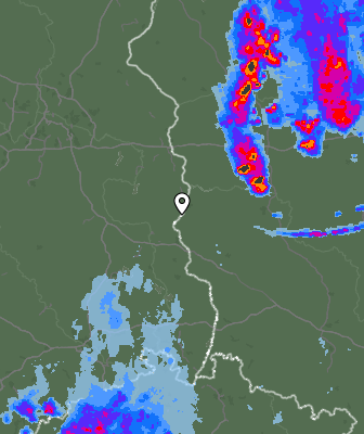 Radar