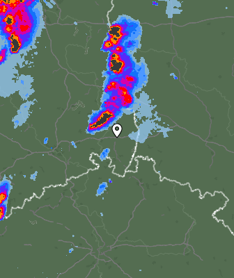 Radar