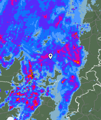Radar