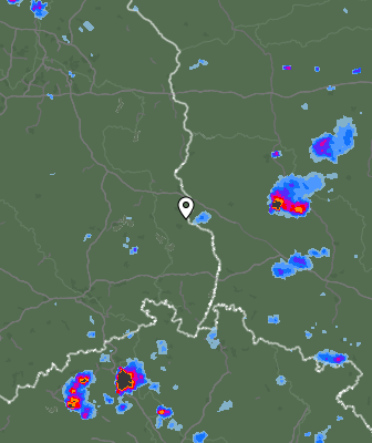 Radar