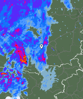 Radar