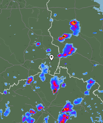 Radar