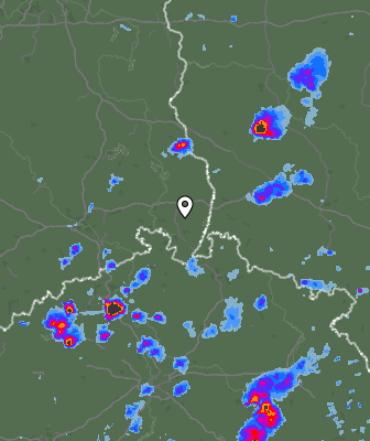 Radar
