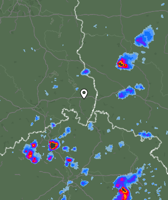 Radar