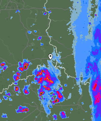Radar