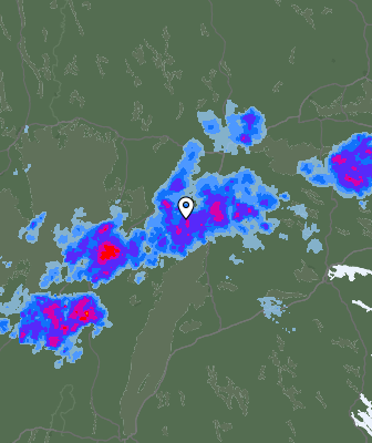 Radar