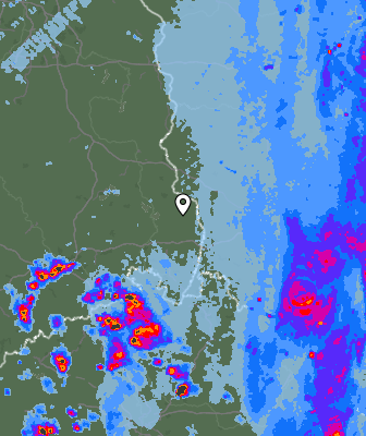 Radar