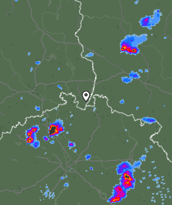 Radar