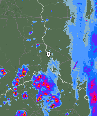 Radar