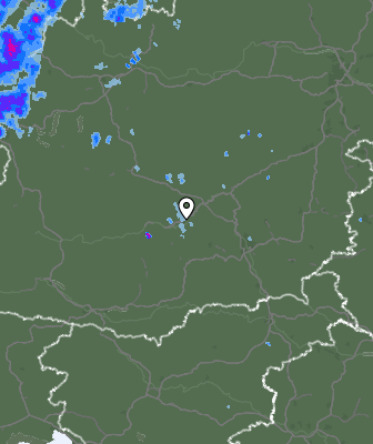 Radar