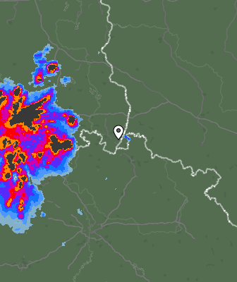 Radar