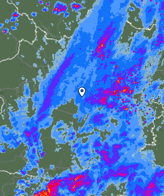 Radar