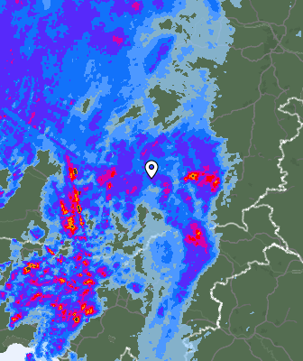 Radar